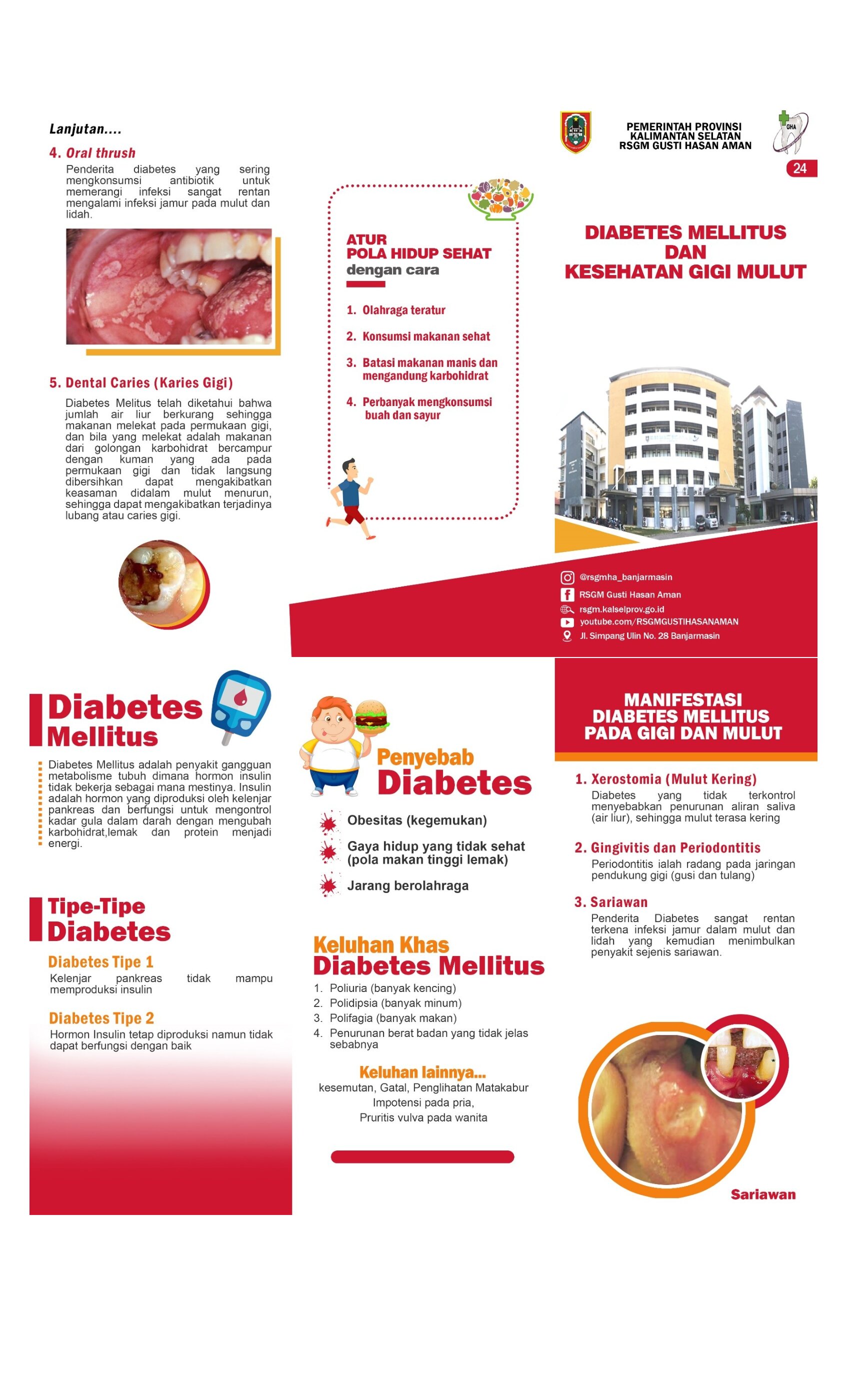 Diabetes Mellitus dan Kesehatan Gigi Dan Mulut