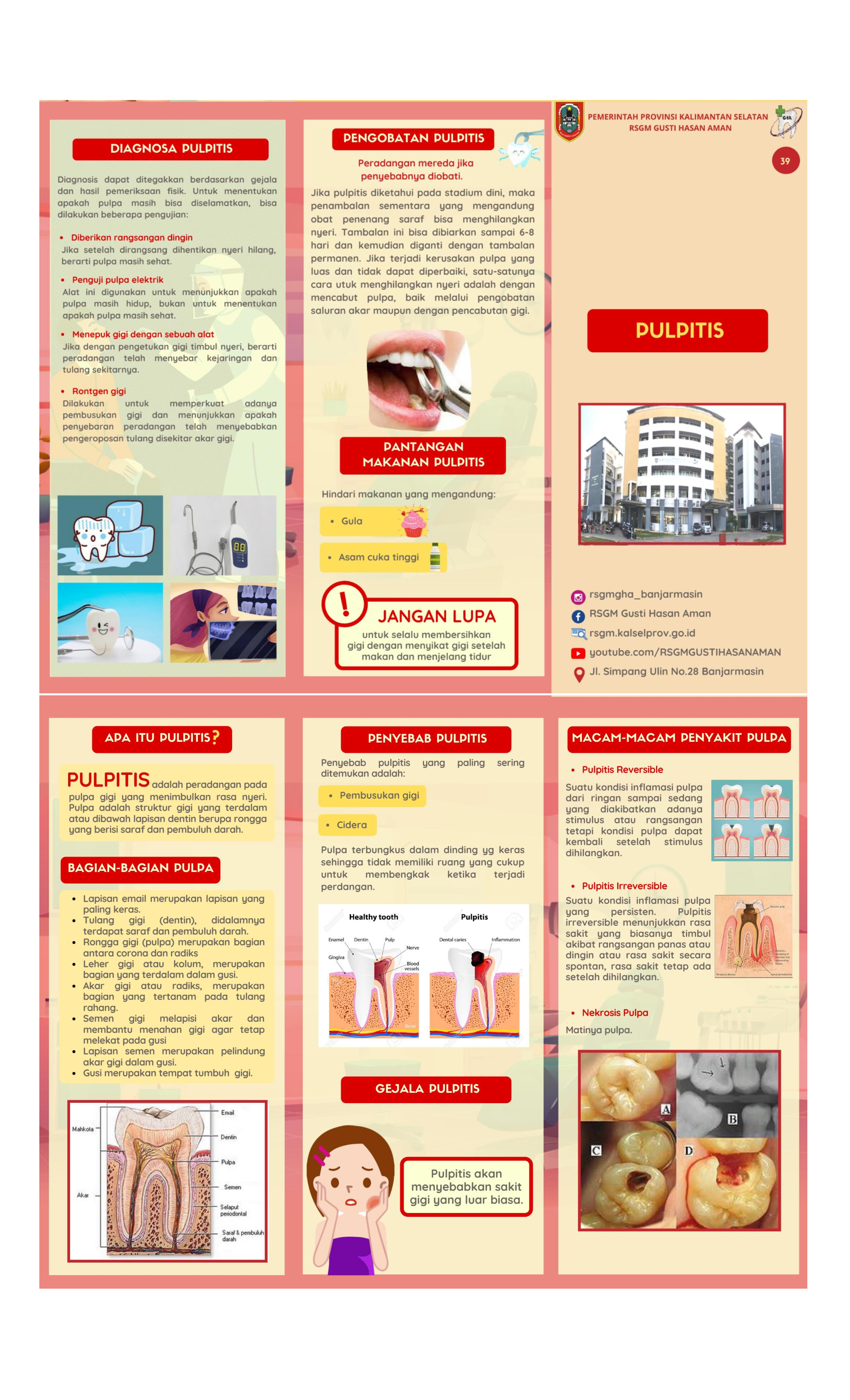 Pulpitis