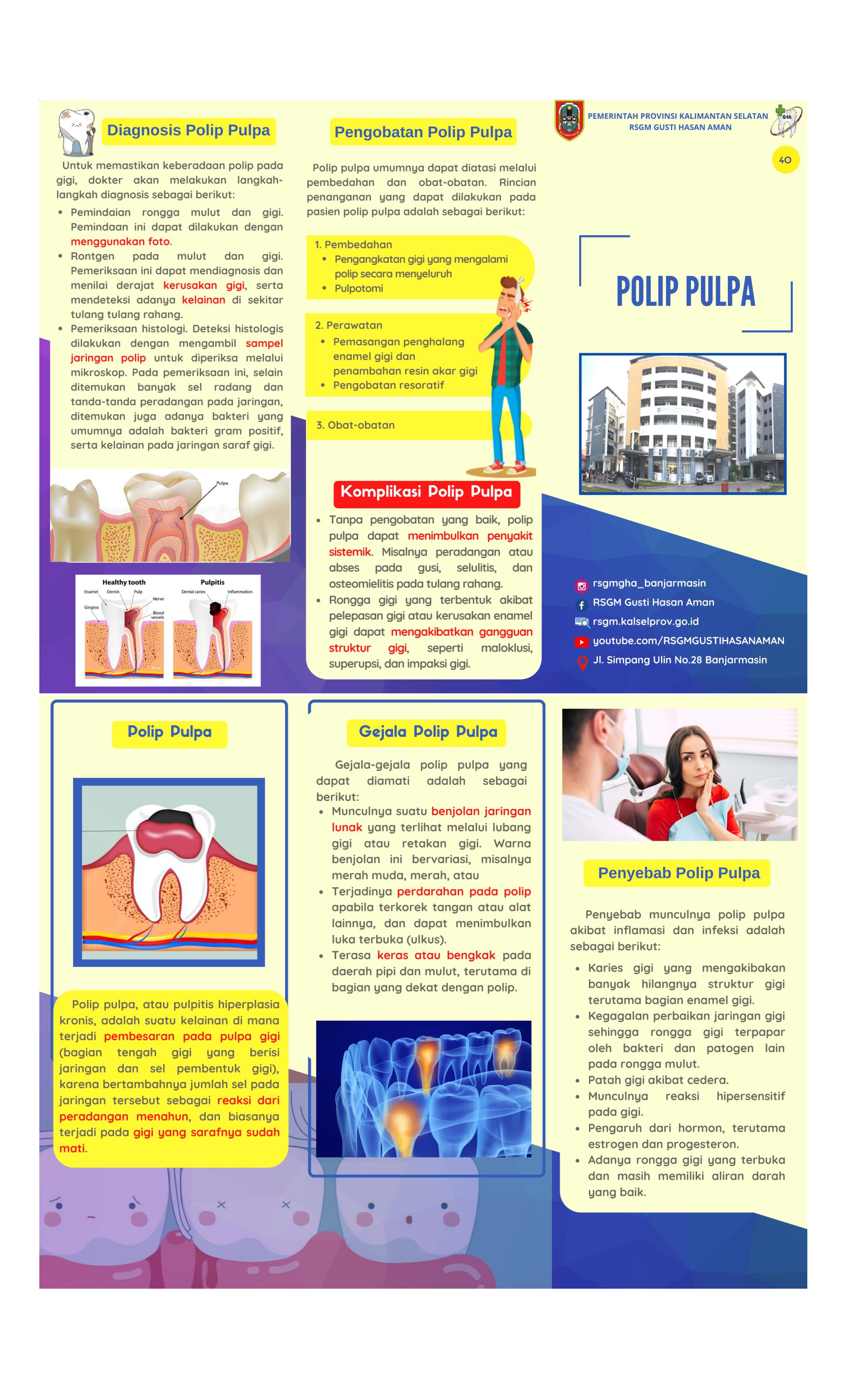 Polip Pulpa