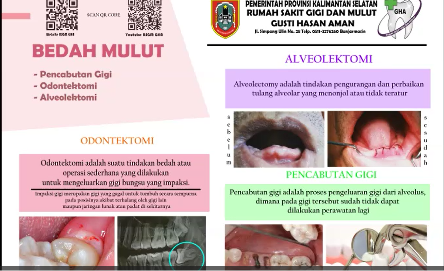 Bedah Mulut